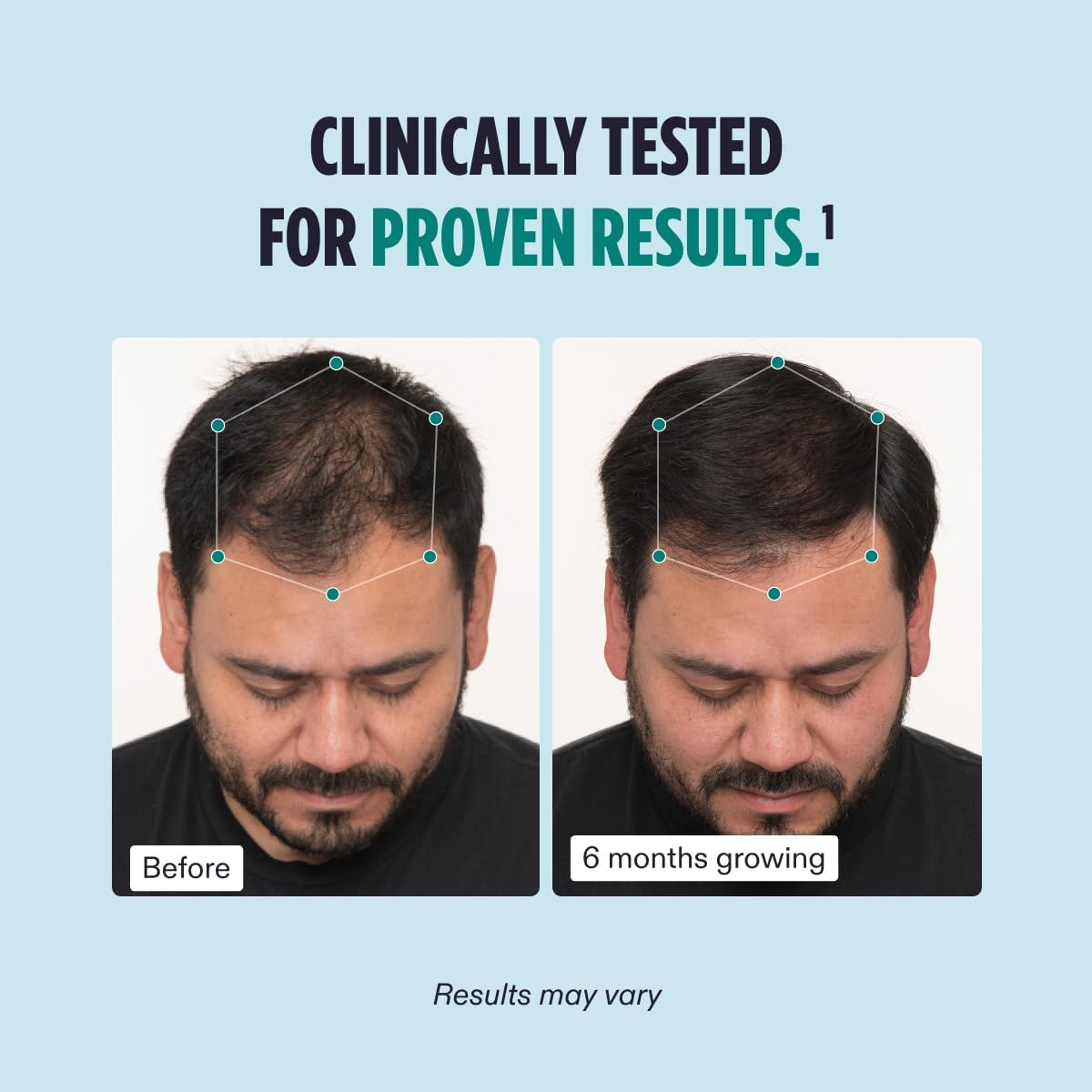 Nutrafol  Men'S Hair Growth Supplements, Clinically Tested for Visibly Thicker Hair and Scalp Coverage, Dermatologist Recommended - 1 Month Supply