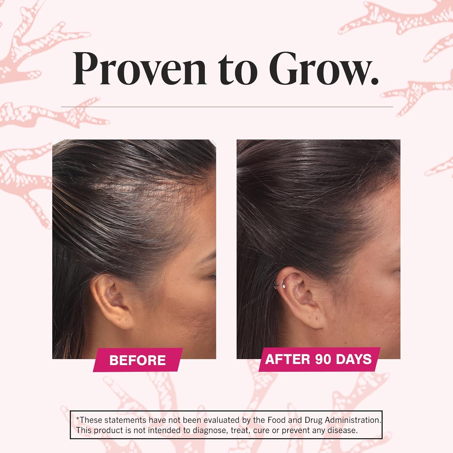 Viviscal  Hair Growth Supplements for Women for Thicker, Fuller Hair, Nourishes Thinning & Loss, with Proprietary Collagen Complex, 60 Tablets, 1 Month Supply