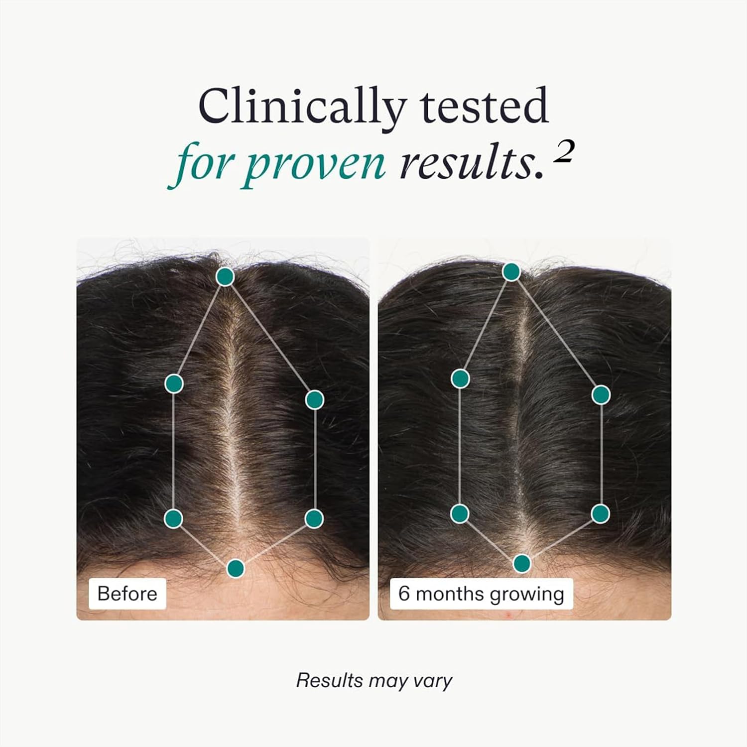 Nutrafol Women'S Hair Growth Supplements, Ages 18-44, Clinically Proven for Visibly Thicker and Stronger Hair, Dairy-Free, Soy-Free, Dermatologist Recommended - 1 Month Supply